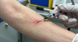 airless injection safety precautions